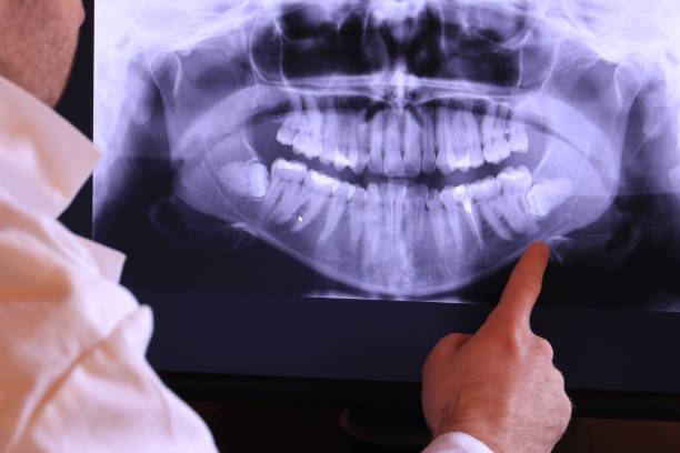 Best Emergency Treatment for Dental Infections or Abscesses in Milmay, NJ